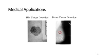 Medical Applications
20
Skin Cancer Detection Breast Cancer Detection
 