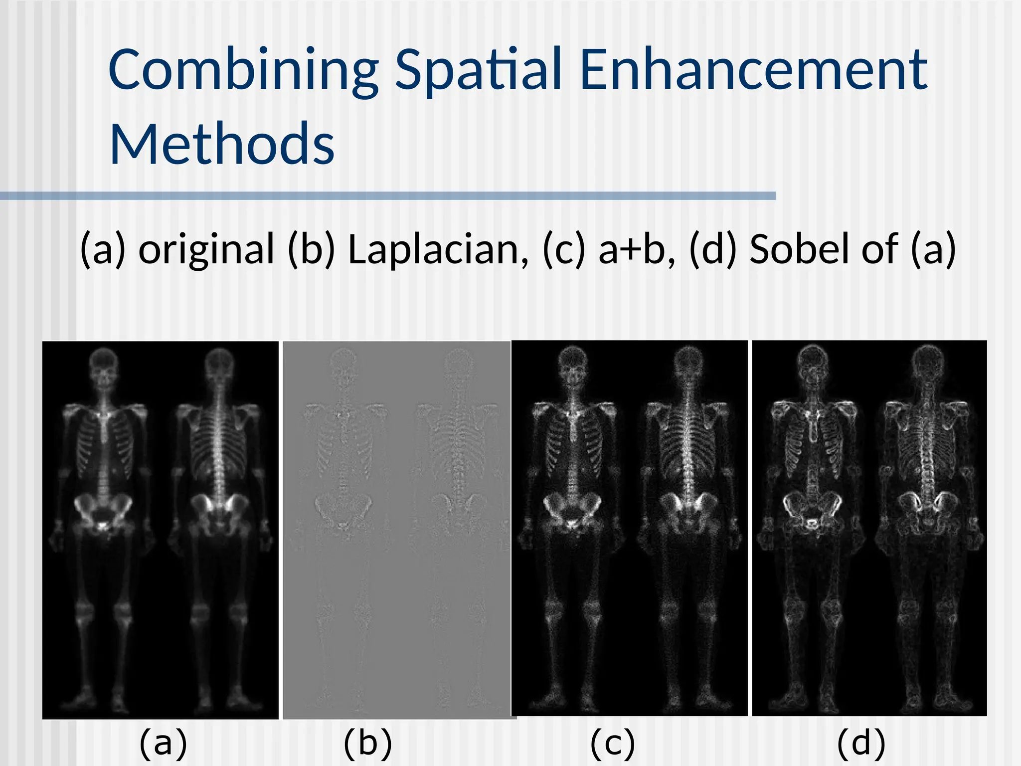 Combining Spatial Enhancement Methods (a) original (b) Laplacian, (c) a+b, (d) Sobel of (a) (a) (b) (c) (d) 