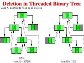 Deletion in Threaded Binary Tree
Case A: Leaf Node need to be deleted
 