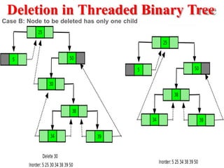 Deletion in Threaded Binary Tree
Case B: Node to be deleted has only one child
 