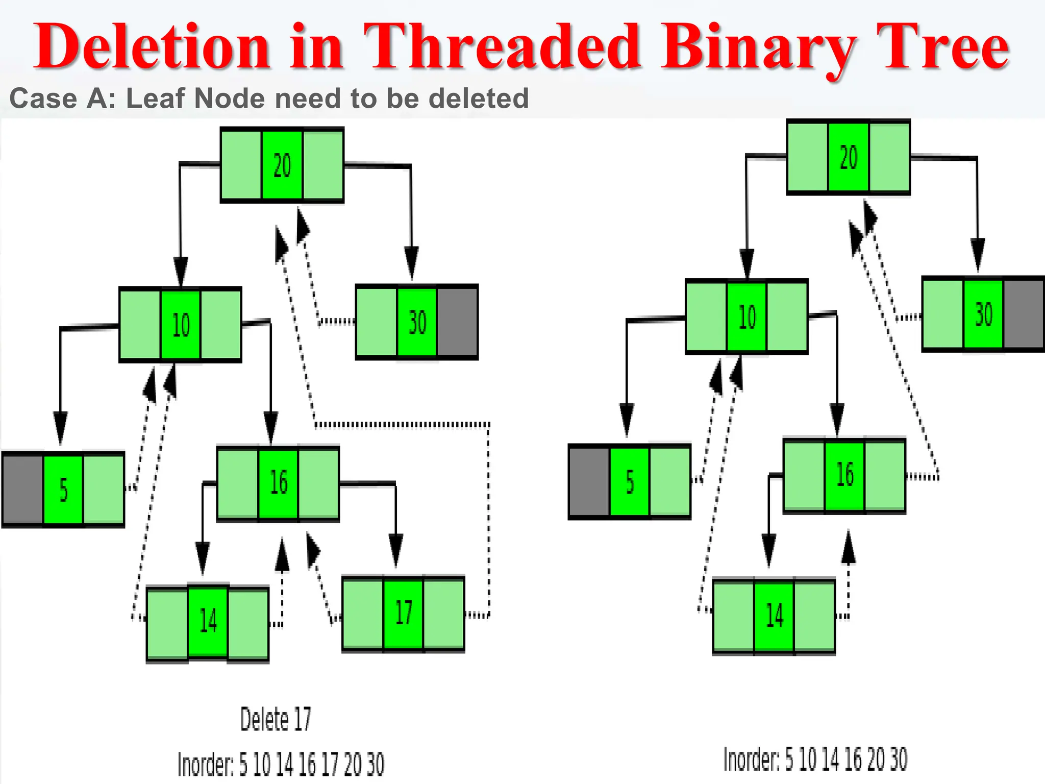 Deletion in Threaded Binary Tree
Case A: Leaf Node need to be deleted
 