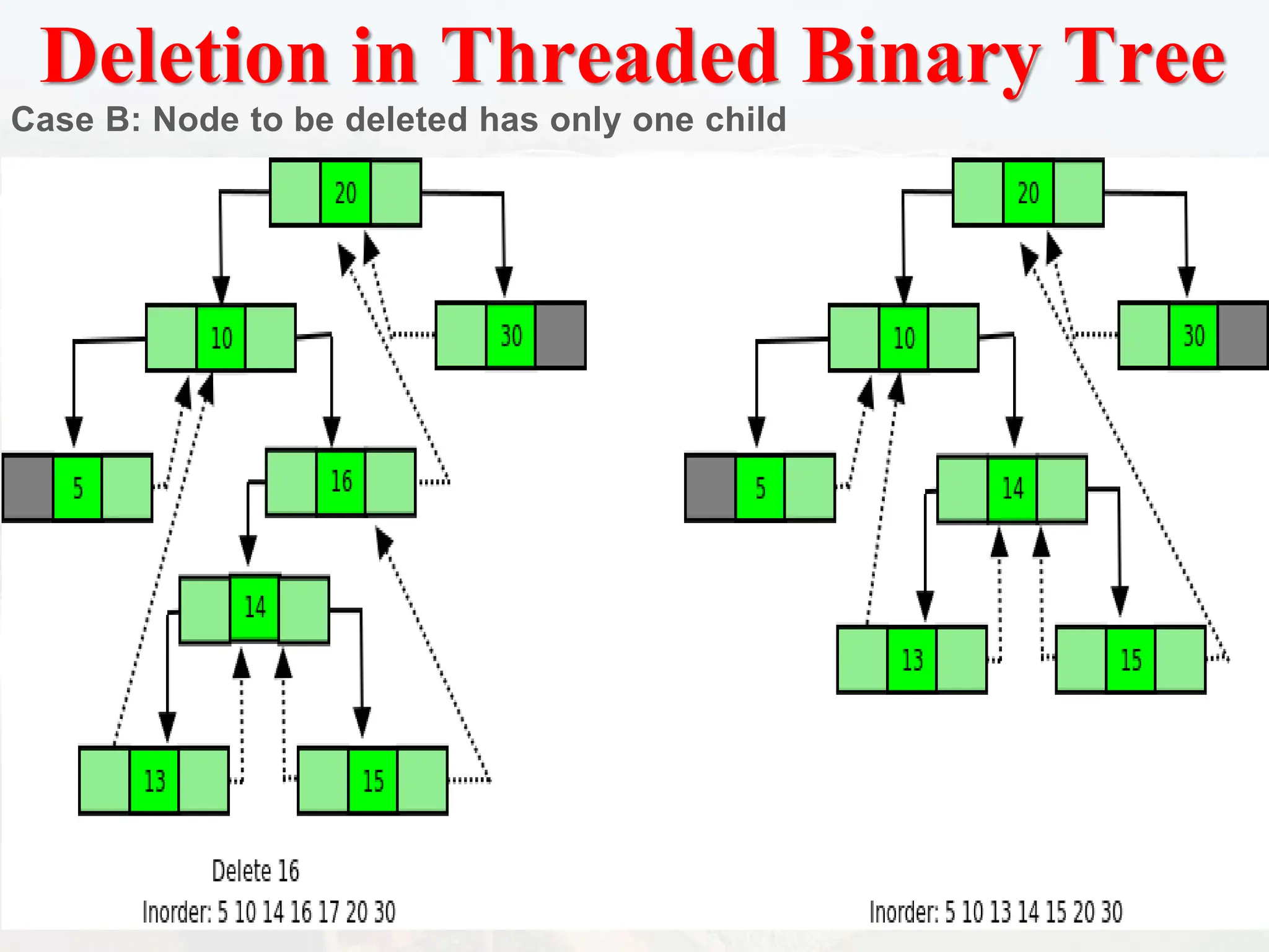 Deletion in Threaded Binary Tree
Case B: Node to be deleted has only one child
 