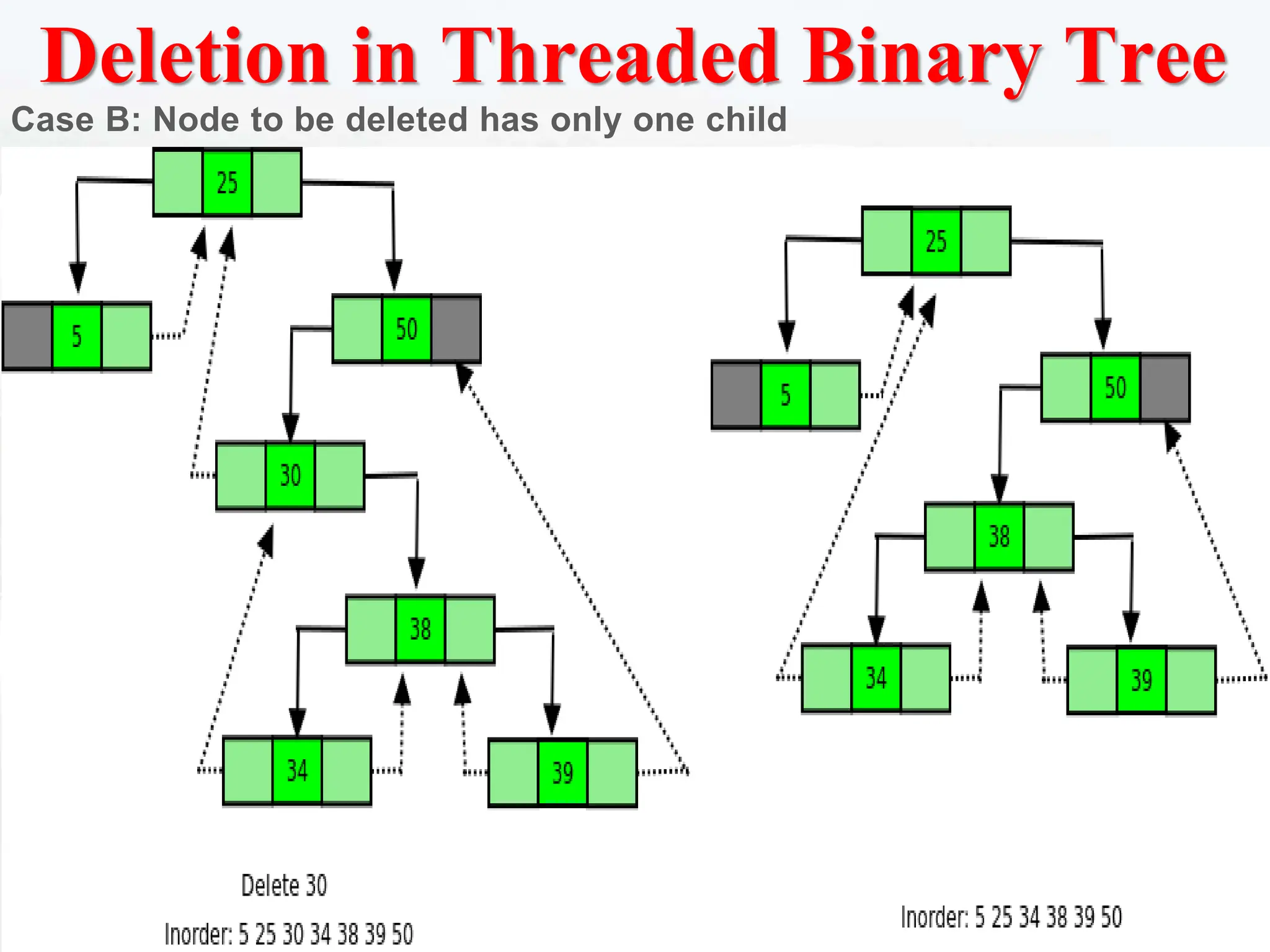 Deletion in Threaded Binary Tree
Case B: Node to be deleted has only one child
 