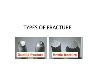 TYPES OF FRACTURE
 