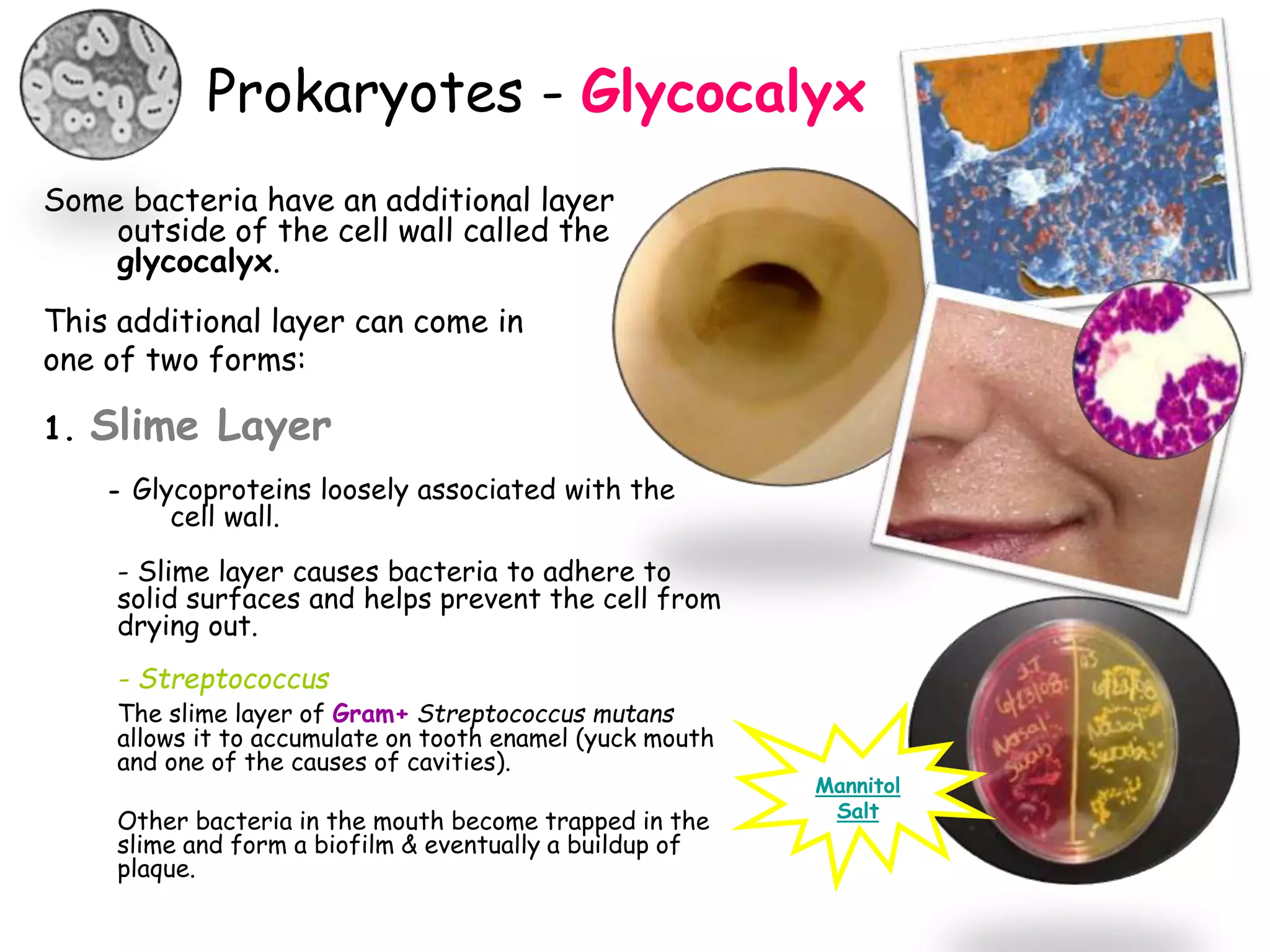 Prokaryotes - Glycocalyx
Some bacteria have an additional layer
outside of the cell wall called the
glycocalyx.
This additional layer can come in
one of two forms:
1. Slime Layer
- Glycoproteins loosely associated with the
cell wall.
- Slime layer causes bacteria to adhere to
solid surfaces and helps prevent the cell from
drying out.
- Streptococcus
The slime layer of Gram+ Streptococcus mutans
allows it to accumulate on tooth enamel (yuck mouth
and one of the causes of cavities).
Other bacteria in the mouth become trapped in the
slime and form a biofilm & eventually a buildup of
plaque.
Mannitol
Salt
 