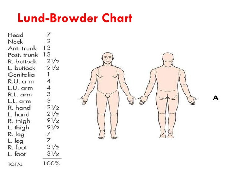 Burn Chart Body