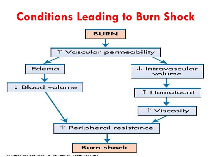Pathophysiology Of Burns Flowchart