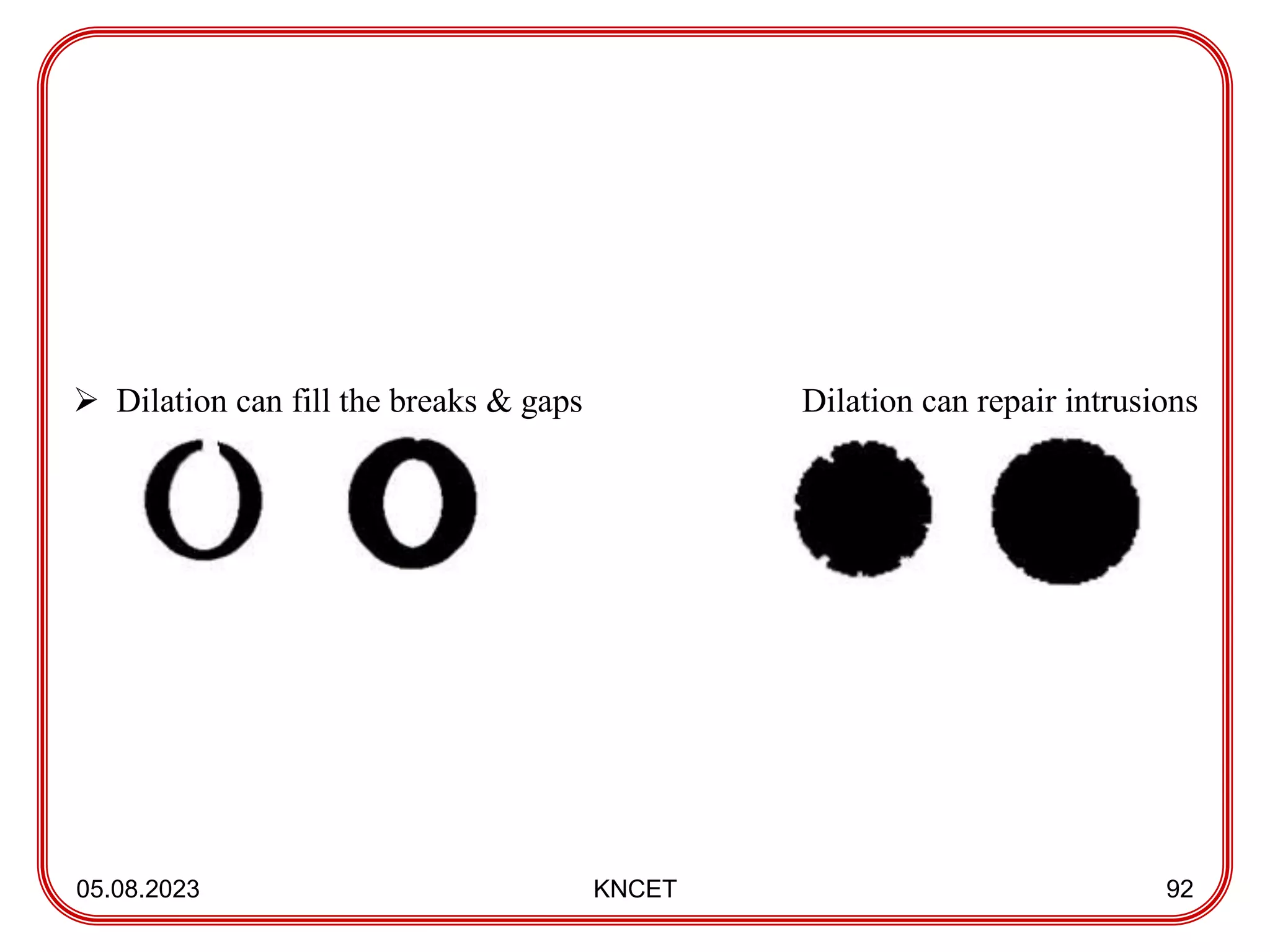 05.08.2023 KNCET 92
 Dilation can fill the breaks & gaps Dilation can repair intrusions
 