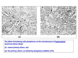 The effect of hardening with phosphorus on the microstructure of hypereutectic
aluminum-silicon alloys:
(a) coarse primary silicon, and
(b) fine primary silicon, as refined by phosphorus addition (x75).
 