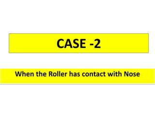 CASE -2
When the Roller has contact with Nose
 