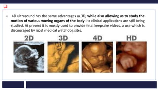 Ultrasound Transducer-biosensors and transducers | PDF