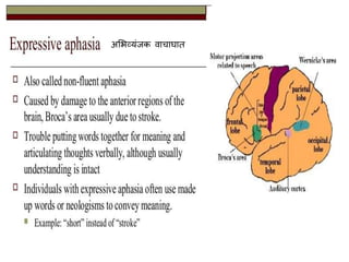 असभव्यंजक वाचार्ात
 
