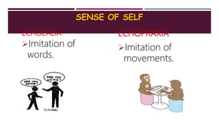 SENSE OF SELF
ECHOLALIA
Imitation of
words.
ECHOPRAXIA
Imitation of
movements.
 