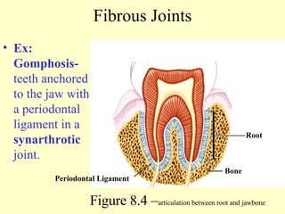 Fibrous Joints Ex: Gomphosis-  teeth anchored to the jaw with a periodontal ligament in a  synarthrotic  joint.  Figure 8.4 – articulation between root and jawbone Periodontal Ligament Bone Root 