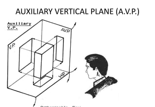 AUXILIARY VERTICAL PLANE (A.V.P.)
 