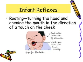 Infant Reflexes
• Rooting—turning the head and
opening the mouth in the direction
of a touch on the cheek
 