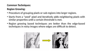 Common Techniques:
Region Growing:
• Procedure of grouping pixels or sub regions into larger regions.
• Starts from a "seed" pixel and iteratively adds neighboring pixels with
similar properties until a certain threshold is met.
• Region growing based techniques are better than the edge-based
techniques in noisy images where edges are difficult to detect.
 
