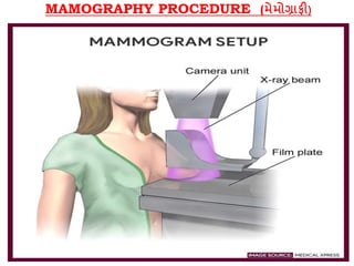 MAMOGRAPHY PROCEDURE (મેમોગ્રાફી)
 