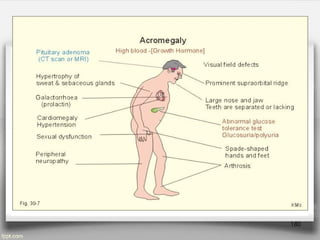 Unit-II Growth Hormones pathophysiology.pptx