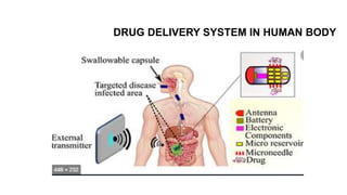 DRUG DELIVERY SYSTEM IN HUMAN BODY
 