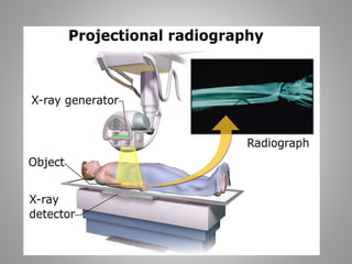Substraction Radiograph Unit Unit ii radio diagnosis and imaging services | PPTX