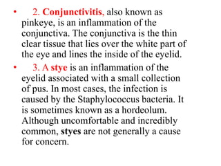 • 2. Conjunctivitis, also known as
pinkeye, is an inflammation of the
conjunctiva. The conjunctiva is the thin
clear tissue that lies over the white part of
the eye and lines the inside of the eyelid.
• 3. A stye is an inflammation of the
eyelid associated with a small collection
of pus. In most cases, the infection is
caused by the Staphylococcus bacteria. It
is sometimes known as a hordeolum.
Although uncomfortable and incredibly
common, styes are not generally a cause
for concern.
 