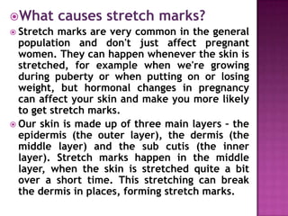 What causes stretch marks?
 Stretch marks are very common in the general
population and don't just affect pregnant
women. They can happen whenever the skin is
stretched, for example when we're growing
during puberty or when putting on or losing
weight, but hormonal changes in pregnancy
can affect your skin and make you more likely
to get stretch marks.
 Our skin is made up of three main layers – the
epidermis (the outer layer), the dermis (the
middle layer) and the sub cutis (the inner
layer). Stretch marks happen in the middle
layer, when the skin is stretched quite a bit
over a short time. This stretching can break
the dermis in places, forming stretch marks.

 