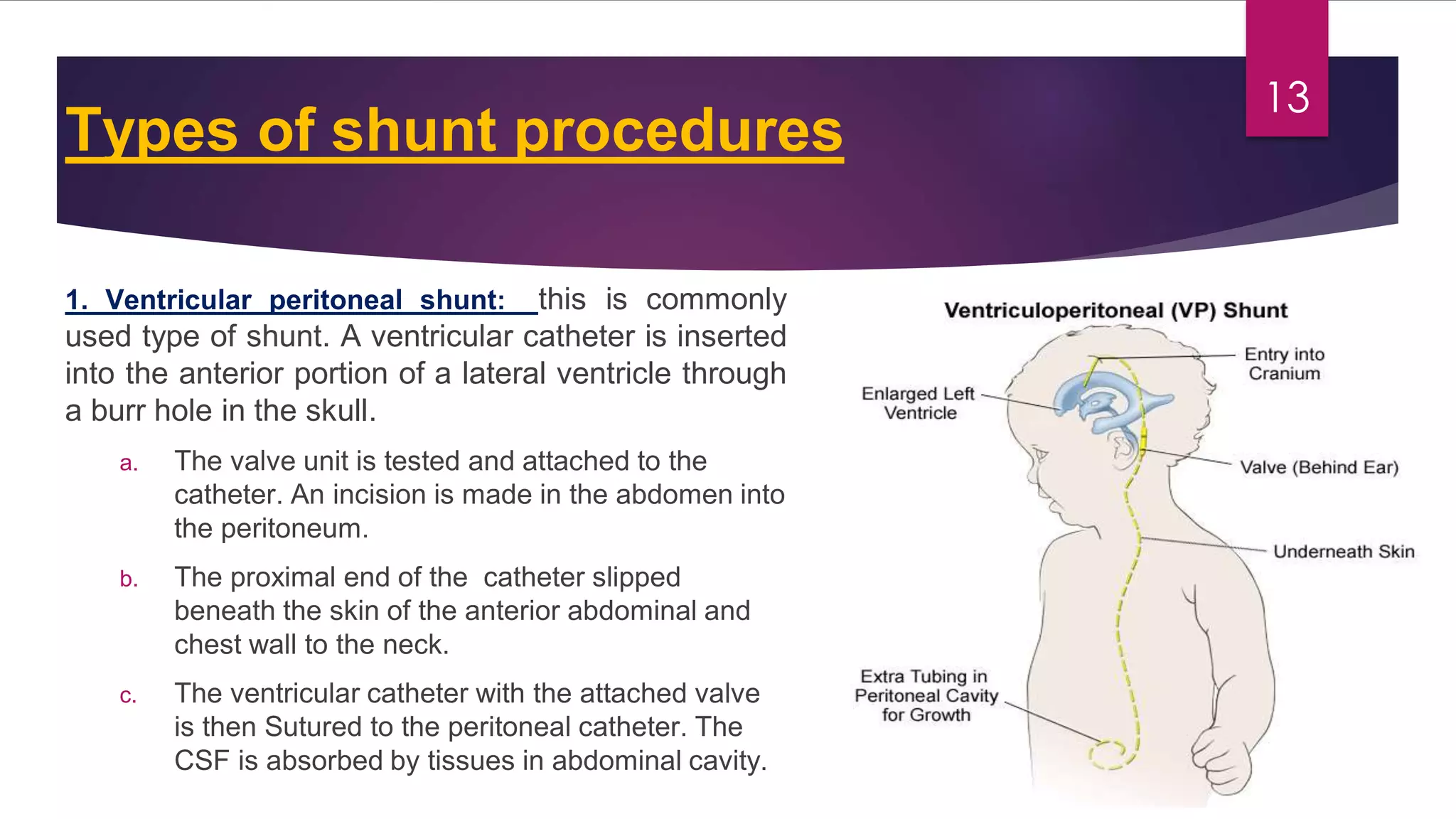 Congenital malformations of the central nervous system | PDF