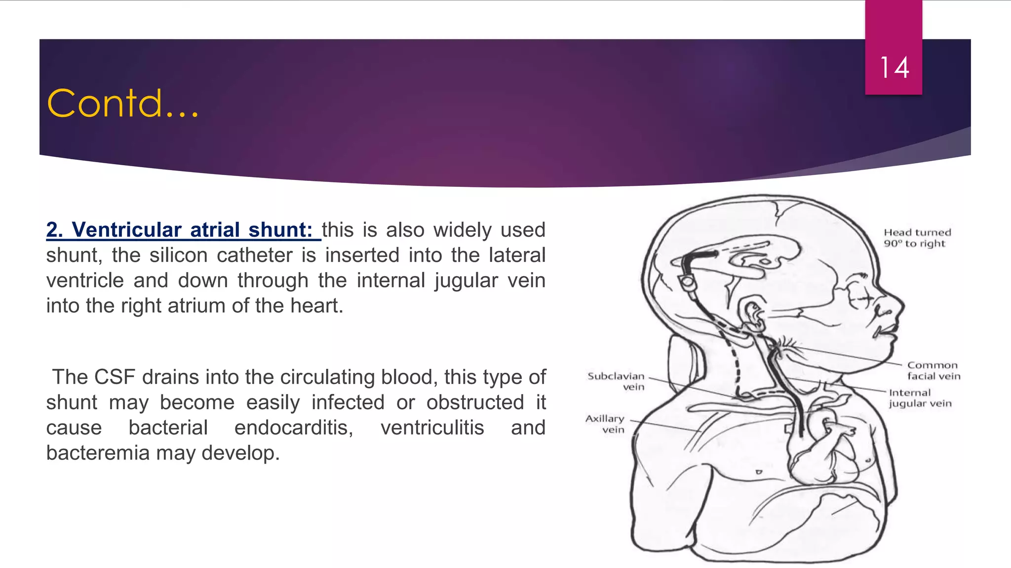 Congenital malformations of the central nervous system | PDF