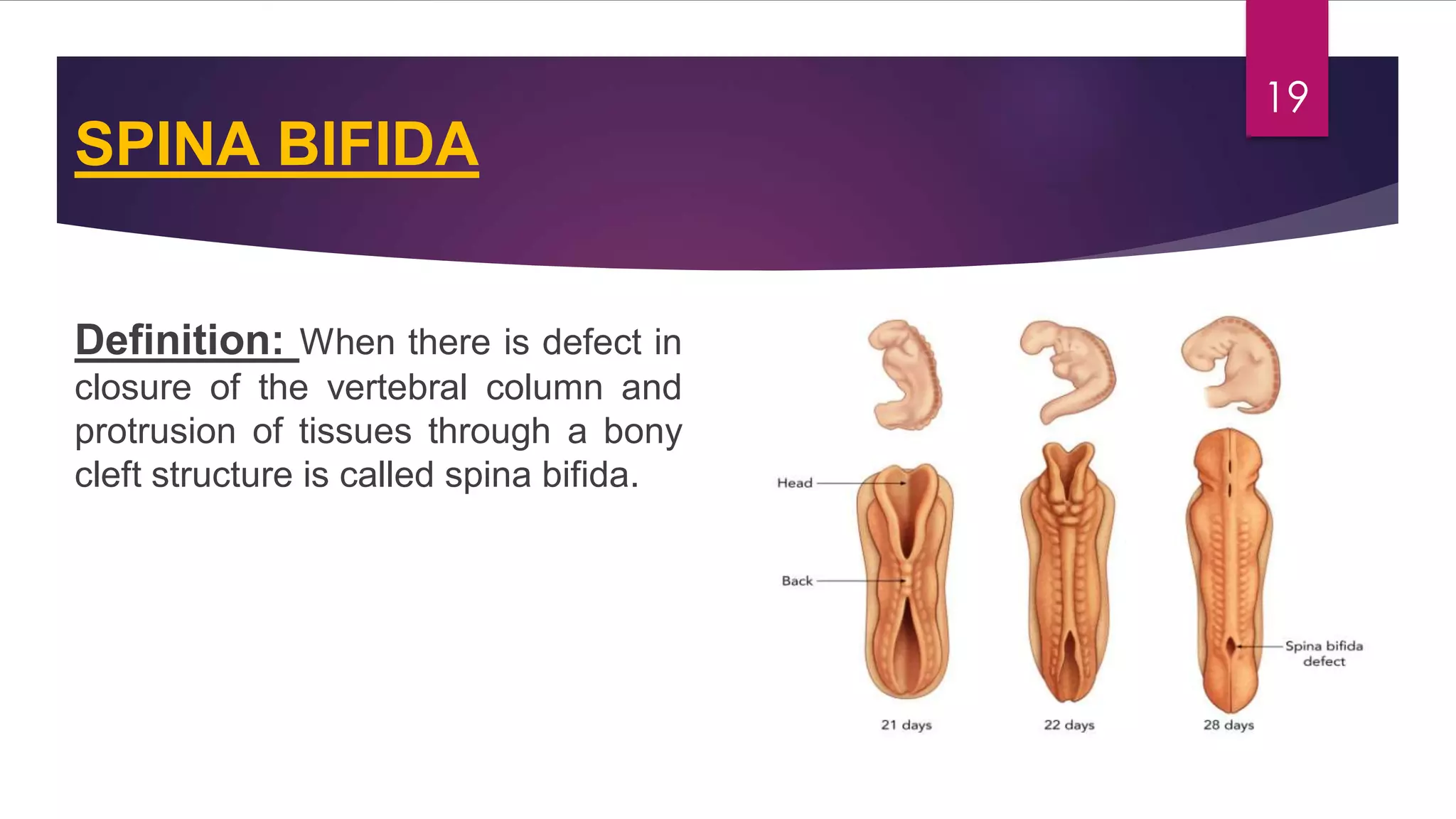 Congenital malformations of the central nervous system | PDF