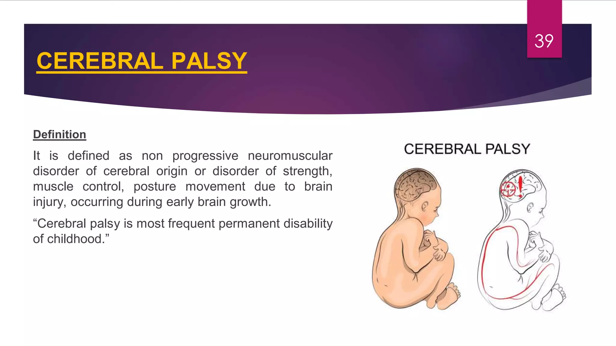 Congenital malformations of the central nervous system | PDF