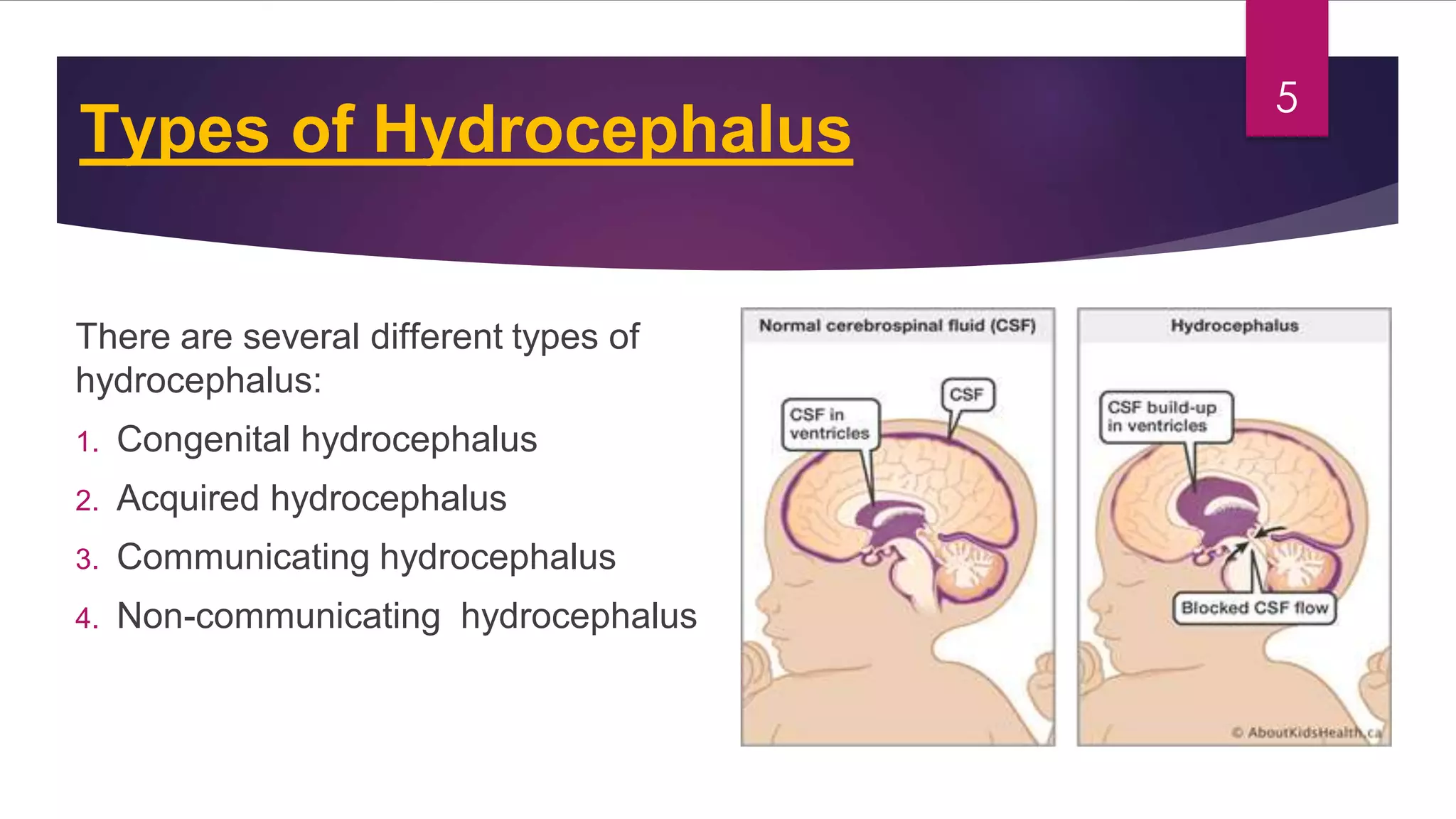 Congenital malformations of the central nervous system | PDF