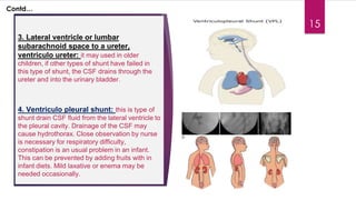 Congenital malformations of the central nervous system | PDF