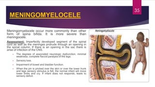 Congenital malformations of the central nervous system | PDF