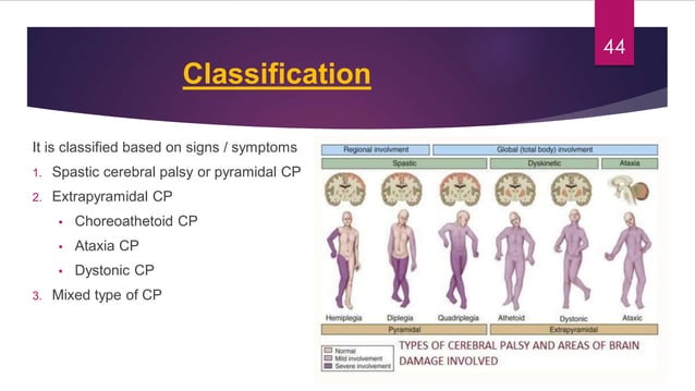 Congenital malformations of the central nervous system | PDF | Brain ...