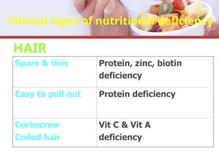 Clinical signs of nutritional deficiency
HAIR
Spare & thin Protein, zinc, biotin
deficiency
Easy to pull out Protein deficiency
Corkscrew
Coiled hair
Vit C & Vit A
deficiency
 