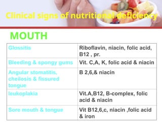 Clinical signs of nutritional deficiency
MOUTH
Glossitis Riboflavin, niacin, folic acid,
B12 , pr.
Bleeding & spongy gums Vit. C,A, K, folic acid & niacin
Angular stomatitis,
cheilosis & fissured
tongue
B 2,6,& niacin
leukoplakia Vit.A,B12, B-complex, folic
acid & niacin
Sore mouth & tongue Vit B12,6,c, niacin ,folic acid
& iron
 
