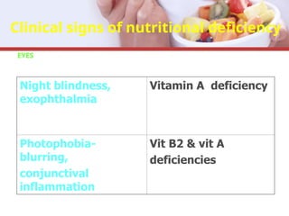 Clinical signs of nutritional deficiency
EYES
Night blindness,
exophthalmia
Vitamin A deficiency
Photophobia-
blurring,
conjunctival
inflammation
Vit B2 & vit A
deficiencies
 