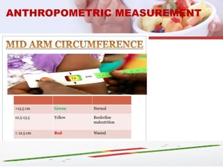 ANTHROPOMETRIC MEASUREMENT
 
