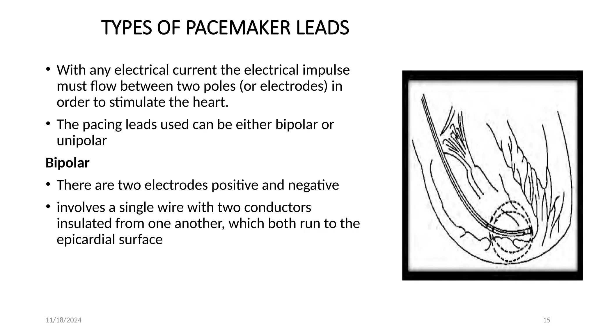 unit#04-7 Cardiac pacing.pptx monitor hearts rate | PPTX