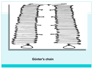 Günter's chain
 