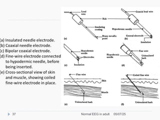 Medical electronics- Bio signal, Electrode, ECG, EEG, PCG | PPT