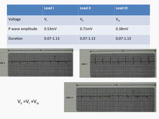 Medical electronics- Bio signal, Electrode, ECG, EEG, PCG | PPT
