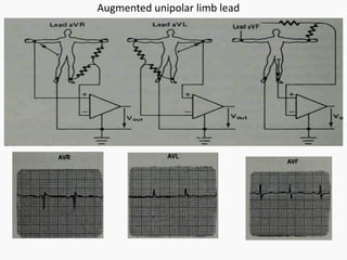 Medical electronics- Bio signal, Electrode, ECG, EEG, PCG | PPT
