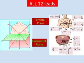 Medical electronics- Bio signal, Electrode, ECG, EEG, PCG | PPT