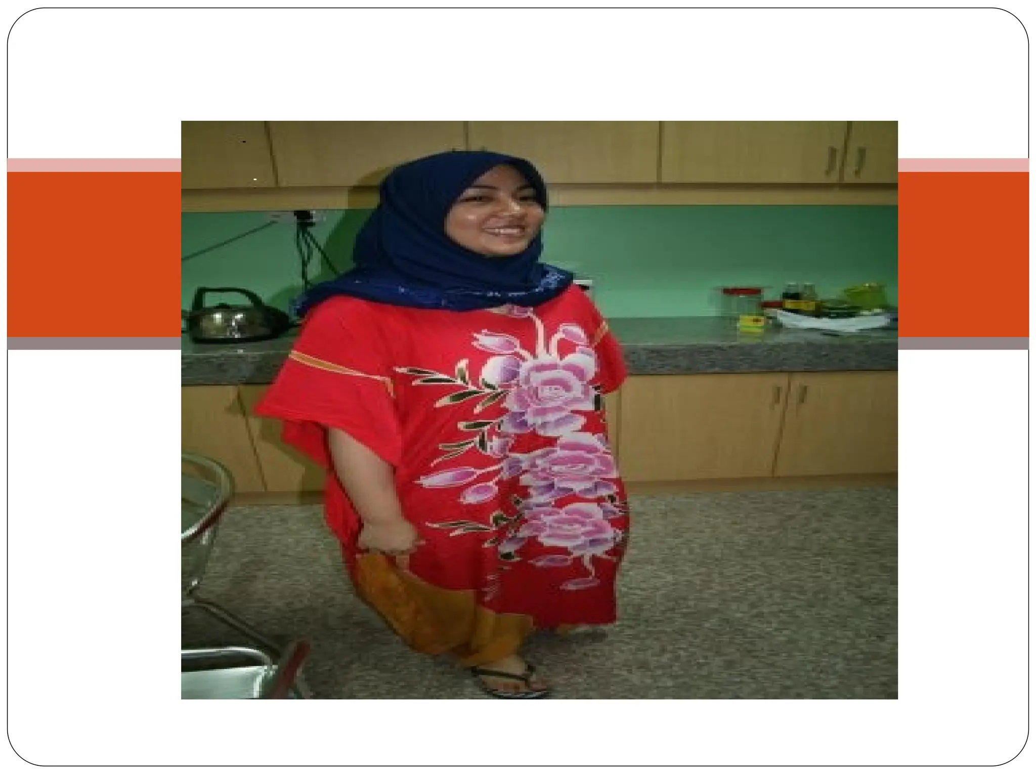 e.g.Cephalopelvic disproportion
 