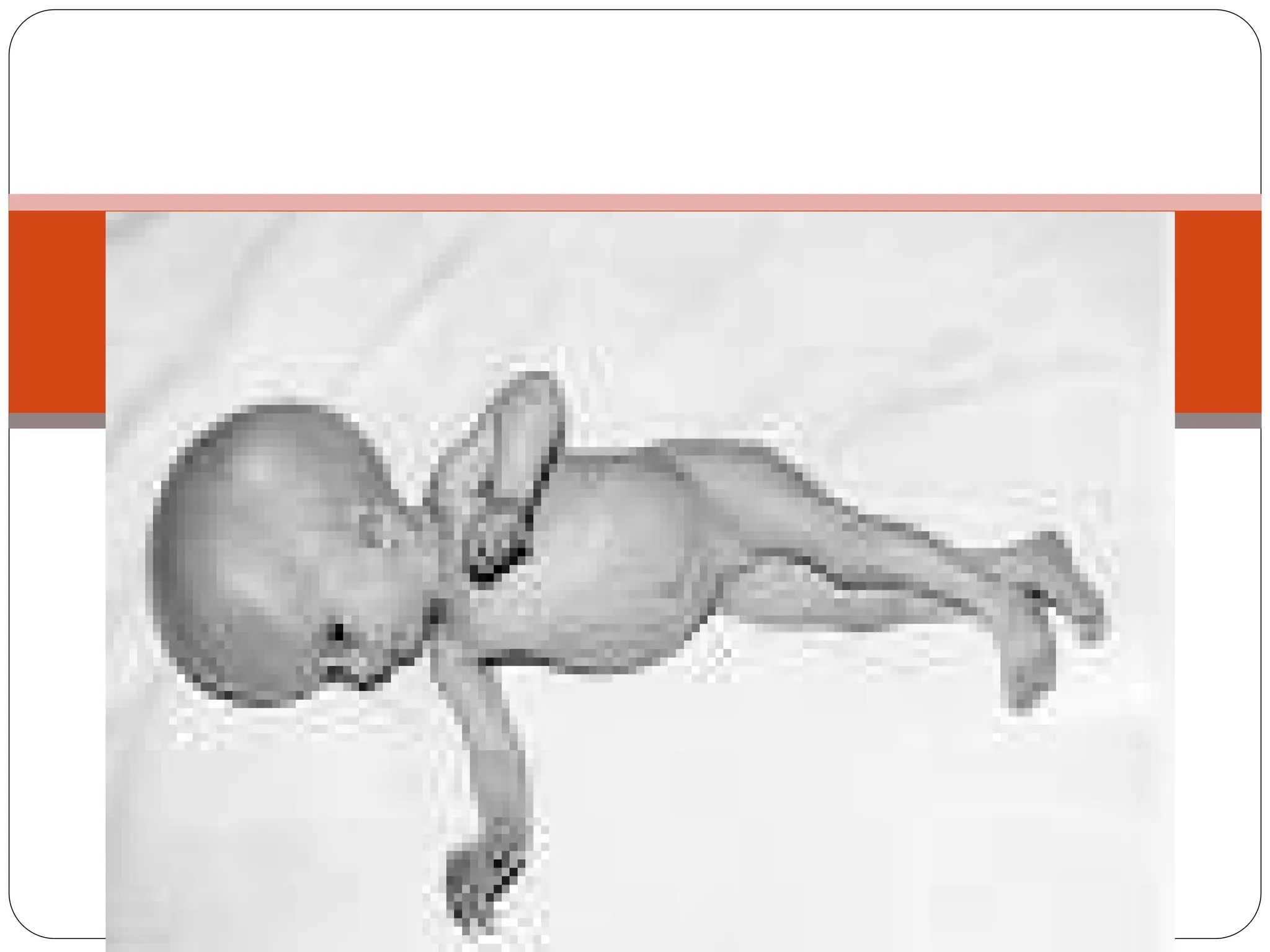 Congenital malformations
 