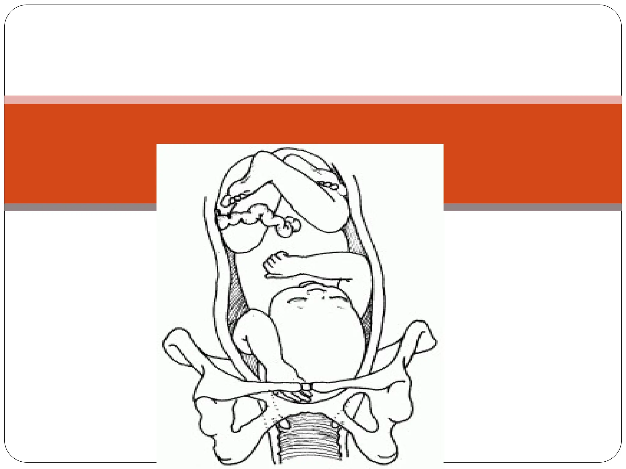 Compound presentation
 