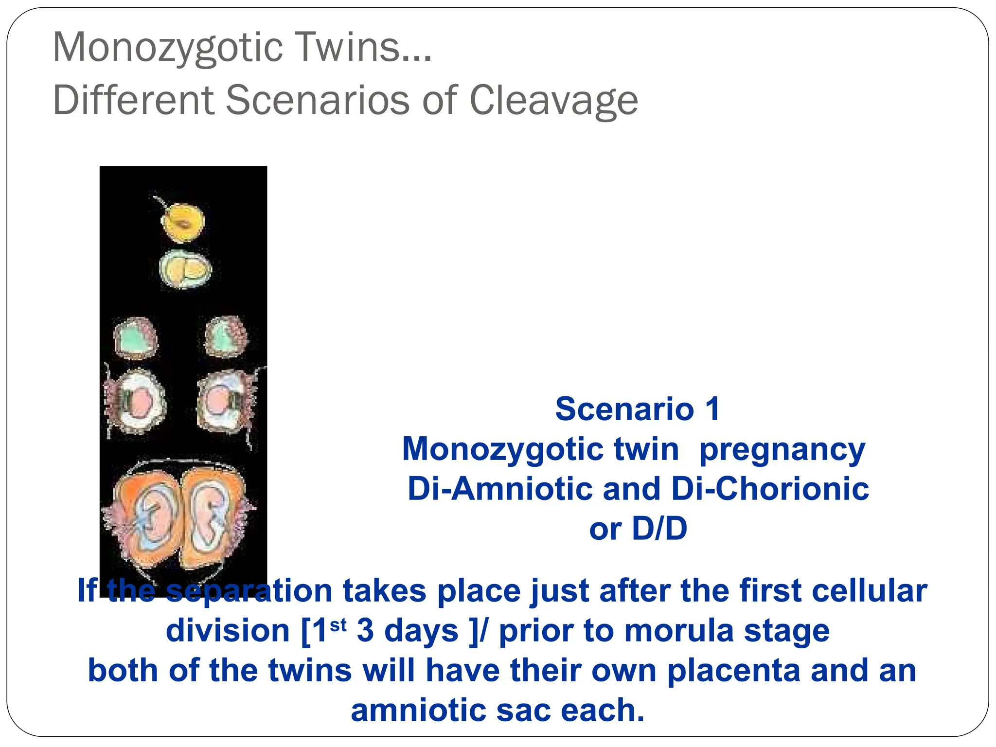 Monozygotic Twins…
Different Scenarios of Cleavage
If the separation takes place just after the first cellular
division [1st
3 days ]/ prior to morula stage
both of the twins will have their own placenta and an
amniotic sac each.
Scenario 1
Monozygotic twin pregnancy
Di-Amniotic and Di-Chorionic
or D/D
 