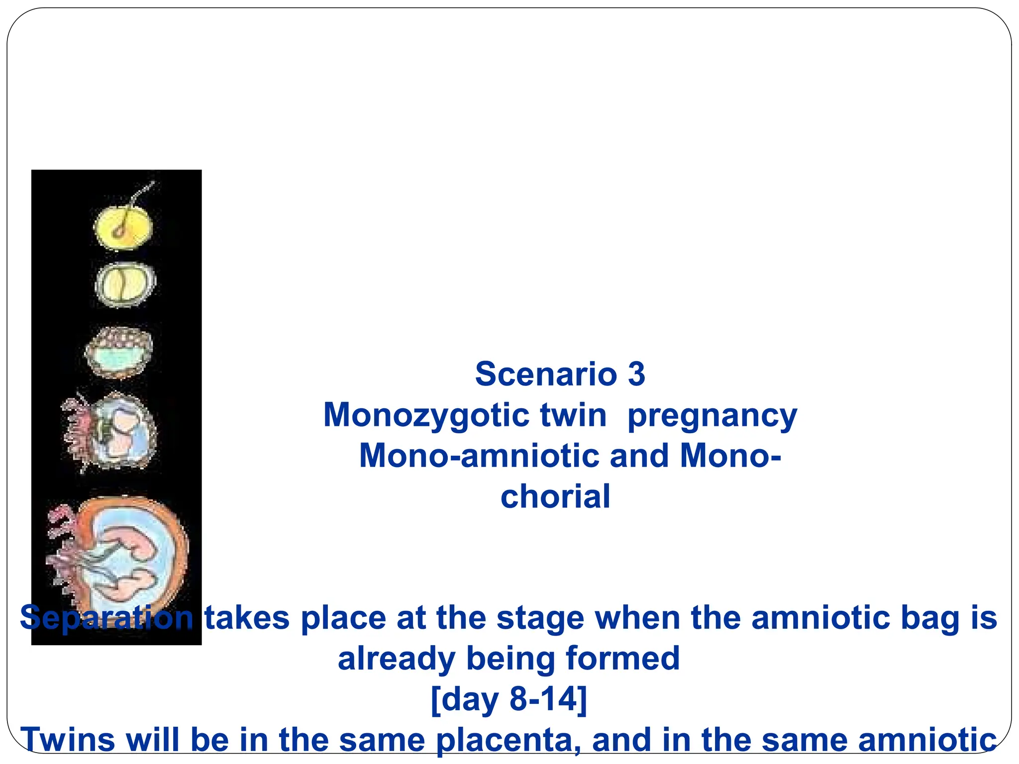 Scenario 3
Monozygotic twin pregnancy
Mono-amniotic and Mono-
chorial
Separation takes place at the stage when the amniotic bag is
already being formed
[day 8-14]
Twins will be in the same placenta, and in the same amniotic
 